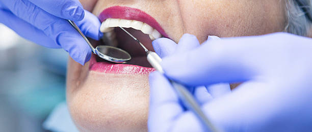 Best Emergency Care for Gum Disease in Leesville, LA